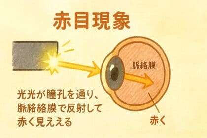 赤目現象 図解光 網膜 反射