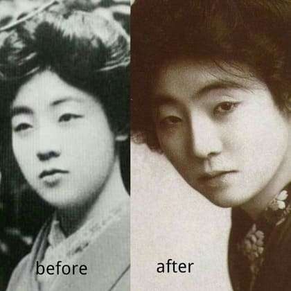 松井須磨子 整形前後